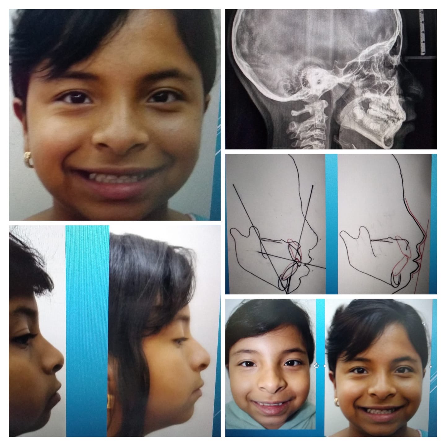 Seguimiento y valoración dental