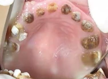 Atención dental especializada